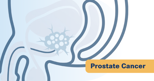 First Patient Dosed in JANX014 Trial in Metastatic CRPC