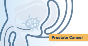 Estradiol Patch Matches Standard Hormone Therapy in Phase 3 Trial