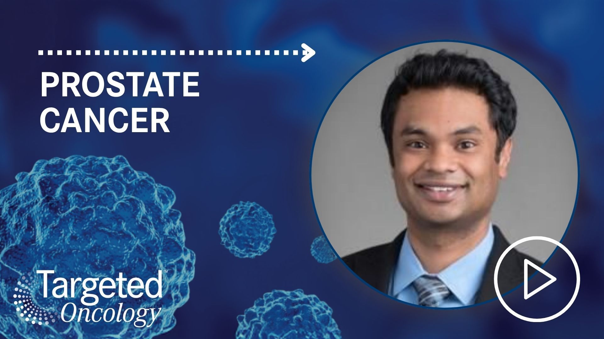 Integrating Frontline Biomarkers and Multidisciplinary Teams in Prostate Cancer | Targeted Oncology - Immunotherapy