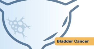 Sacituzumab Combo Shows Promise in Bladder Preservation Trial