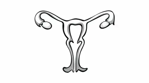 Clinical Commentary: Managing Adverse Events From PARP Inhibitors in Advanced Ovarian Cancer - Targeted Oncology