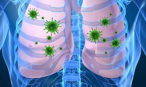 Strategies and Trends in the Management of Lung Cancer