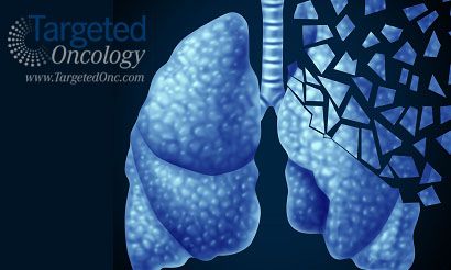 Best options for treating nsclc