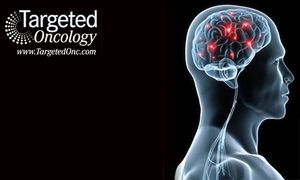 New Options Possible in Patients With NSCLC and Brain Metastases