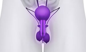 CTC and LDH Panel Shown to be Surrogate for OS in Prostate Cancer