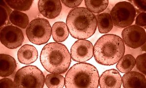 BTK, PLCG2 Mutations Associated With Ibrutinib Resistance