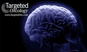 Laser Ablation Makes Headway in Brain Cancer