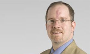 Treating Squamous vs Nonsquamous Disease