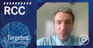 Dr Srour Highlights ALLO-316 Phase 1 Success in Advanced ccRCC