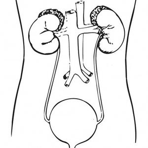 Growth Factors Play Emerging Role in Bladder Cancer