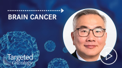 GammaTile Cuts Treatment Delay in Glioblastoma