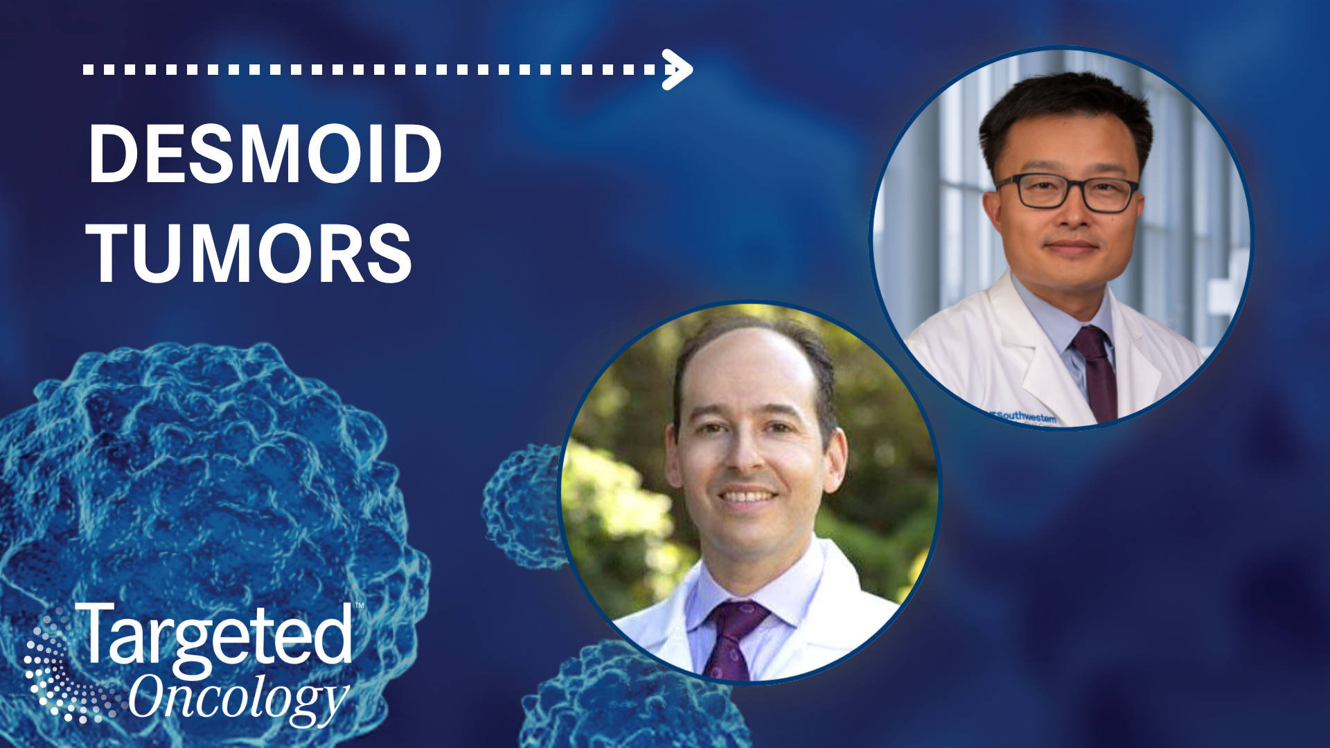 Decisions on How to Treat Progressive Desmoid Tumors