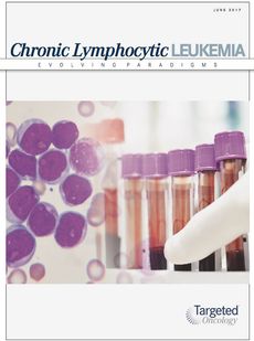 Chronic Lymphocytic Leukemia