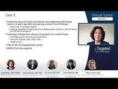 EP. 13 Case 3: Metastatic Triple-Negative Breast Cancer