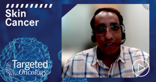 Targeting Nitrosylation: A New Strategy for NRAS-Mutant Melanoma