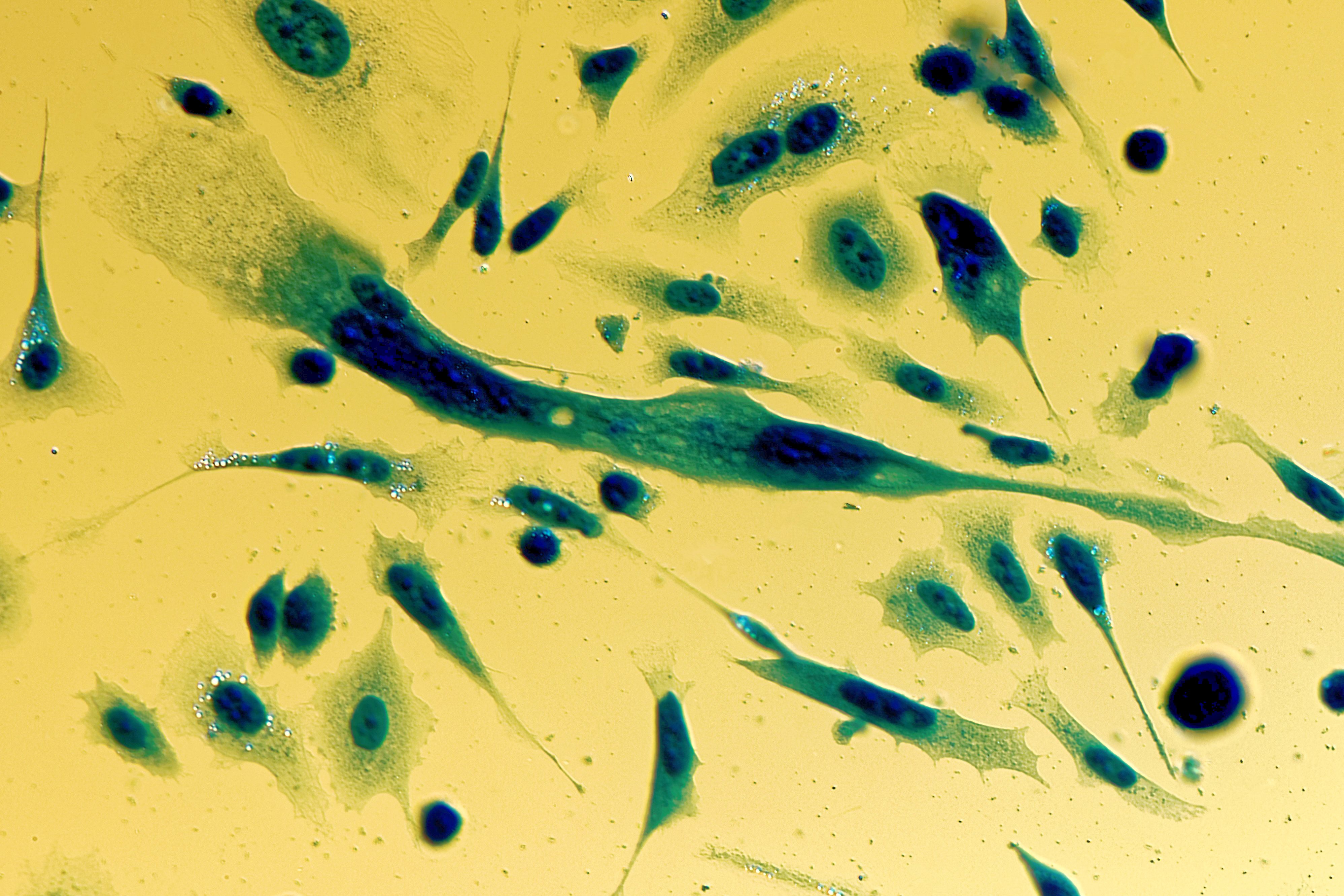 Las interacciones AR multivalentes ofrecen avances potenciales en el cáncer de próstata Las interacciones AR multivalentes ofrecen avances potenciales en el cáncer de próstata