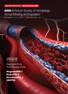 64th ASH Multiple Myeloma Meeting Spotlight