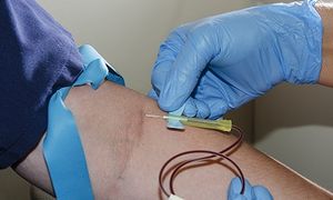 Accurate Blood Test for Diagnosis of Lung Cancer Could Save Lives