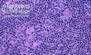 The Emerging Role of Checkpoint Inhibitors in Lymphoid Malignancies