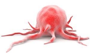 Weight May Affect Toxicity of Immunotherapies