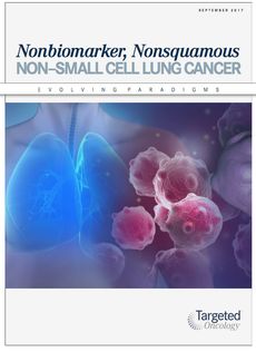 Non-Small Cell Lung Cancer