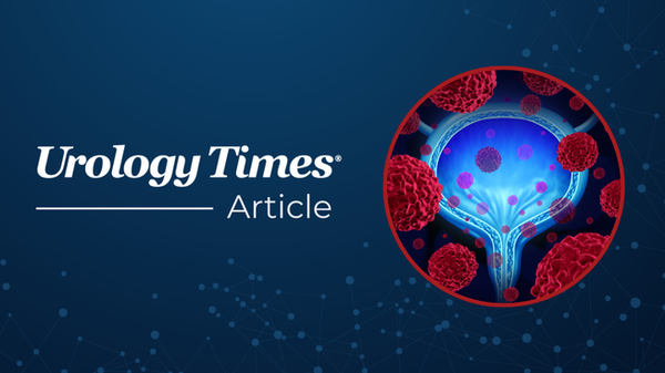 FDA greenlights phase 1 study of UGN-501 for NMIBC
