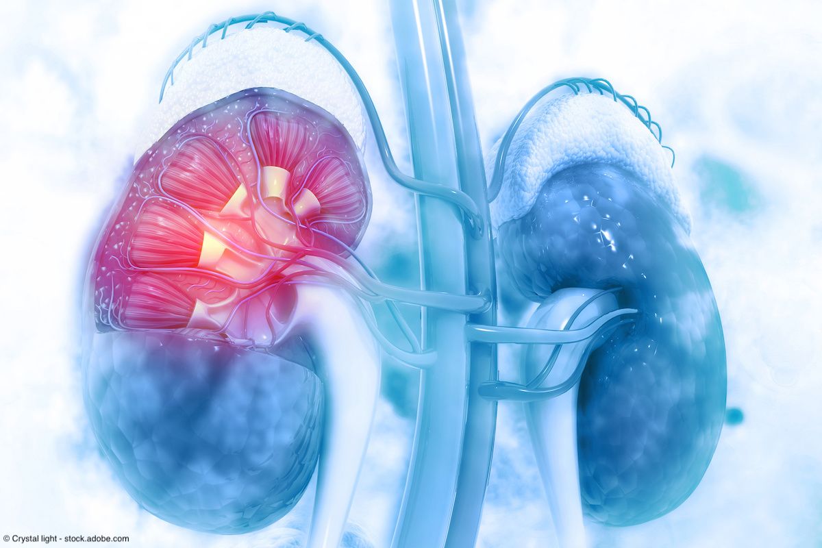 Belzutifan approved in EU for renal cell carcinoma