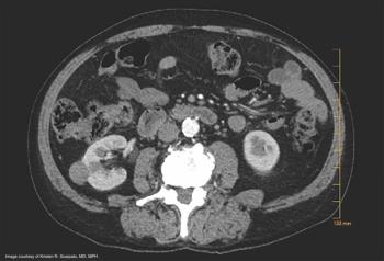 Image courtesy of Kristen R. Scarpato, MD, MPH