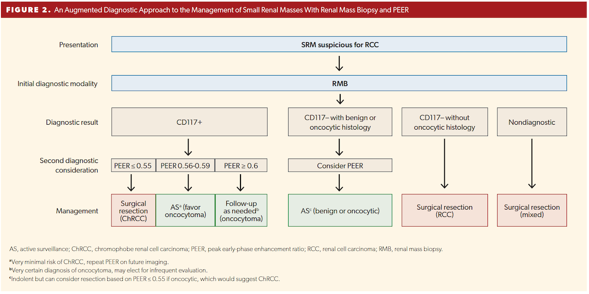 An Augmented Diagnostic Approach to the Management of Small Renal Masses With Renal Mass Biopsy and PEER An Augmented Diagnostic Approach to the Management of Small Renal Masses With Renal Mass Biopsy and PEER