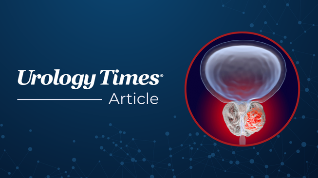<![CDATA[BULLSEYE: 177Lu-PSMA-617 may delay disease progression in oligometastatic HSPC]]>