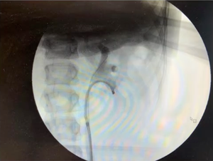 Pediatric ureteroscopy: Principles for safe surgery