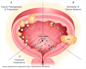 Source: Reprinted from Urology 2019; 126:11 with permission from Elsevier