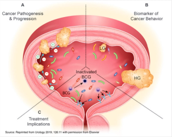 Source: Reprinted from Urology 2019; 126:11 with permission from Elsevier