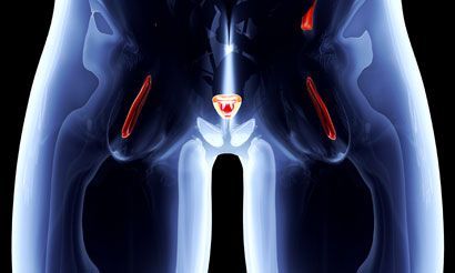 “We believe SAR-Bombesin will play a role in the identification of disease that is not observed with conventional imaging or PSMA-PET," said Louise Emmett, MBChB, FRACP, MD.