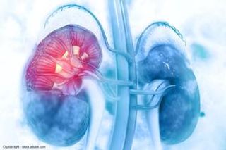 Dr. Brugarolas on rationale for targeting HIF2α in renal cell carcinoma