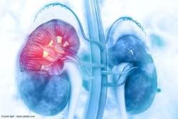 Enrollment completed in trial of novel imaging agent for kidney cancer