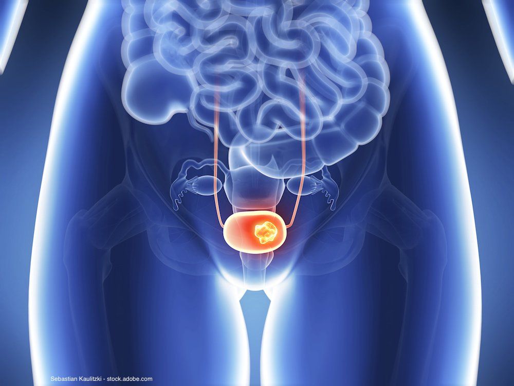 Sebastian Kaulitzki - stock.adobe.com