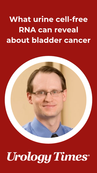 What urine cell-free RNA can reveal about bladder cancer