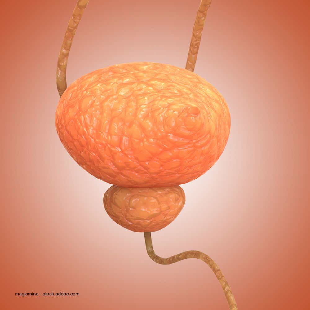 magicmine - stock.adobe.com