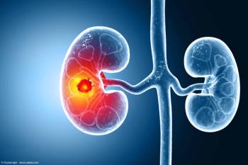 Medically accurate illustration of kidney cancer. showing presence of cancerous tumor inside the kidney. 3d illustration | Image Credit: © Crystal light - stock.adobe.com