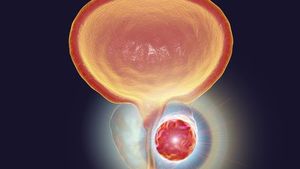 Subgroup data sustain enzalutamide PFS benefit in nmCRPC