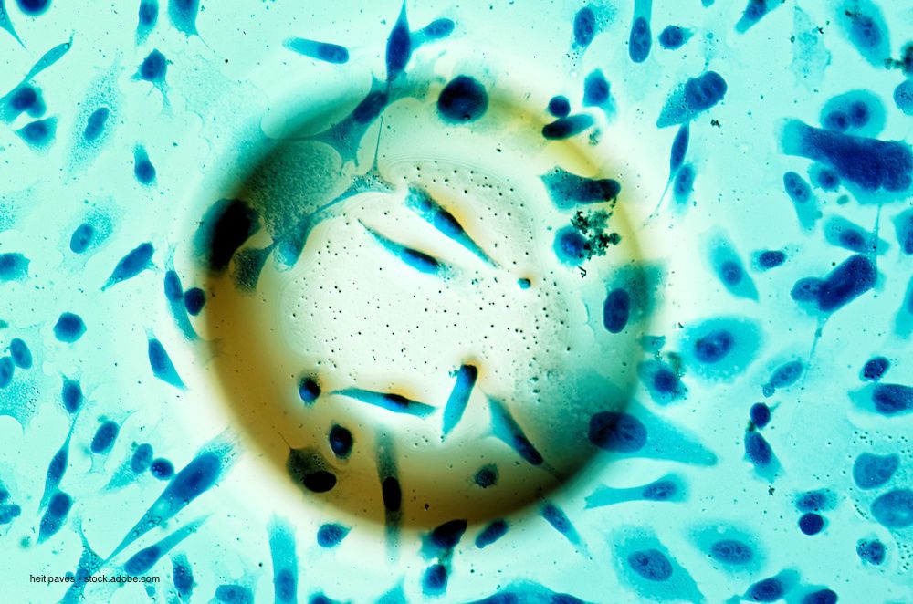 heitipaves - stock.adobe.com