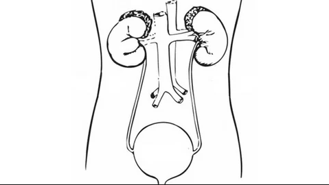 Changes in Management After 18F-DCFPyL PSMA PET in Patients