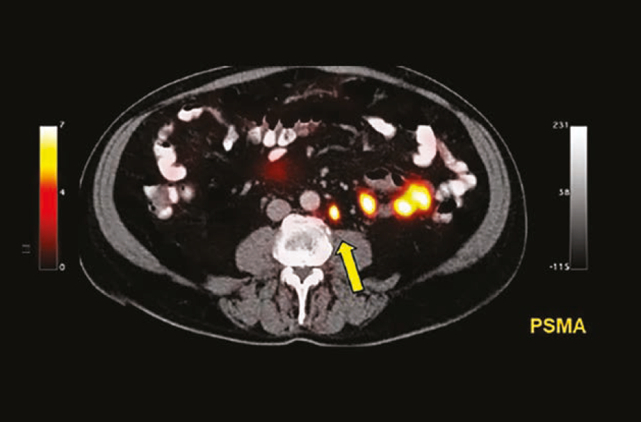 Image courtesy of the University of California, Los Angeles
