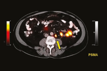 Image courtesy of the University of California, Los Angeles