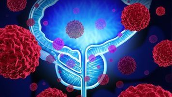 Pivotal Data Published For Sacituzumab Govitecan In Bladder Cancer