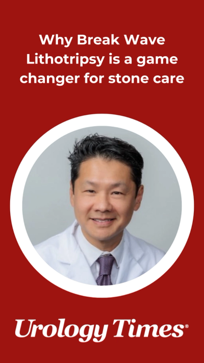 Why Break Wave Lithotripsy is a game changer for stone care