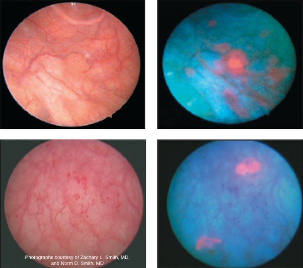 Photographs courtesy of Zachary L. Smith, MD, and Norm D. Smith, MD