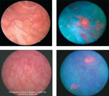 Photographs courtesy of Zachary L. Smith, MD, and Norm D. Smith, MD