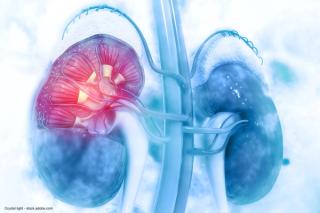 Immunotherapy revolutionizes frontline treatment in advanced RCC